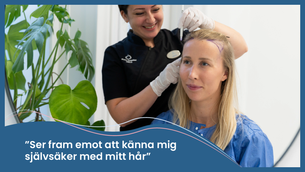 Hårtransplantation resultat