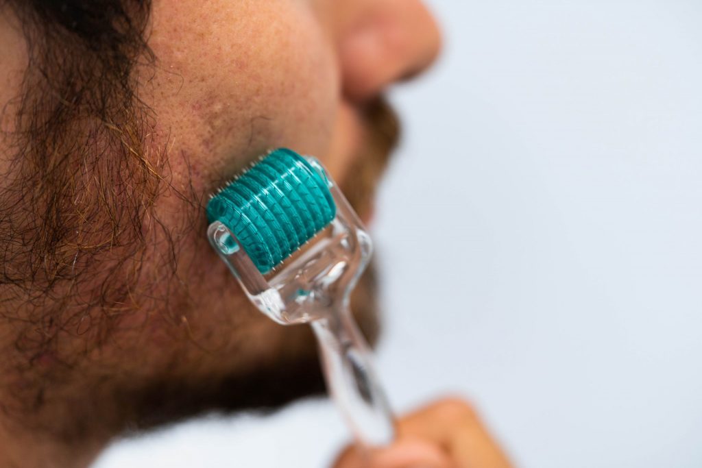 A man uses a dermaroller for beard, hair roller