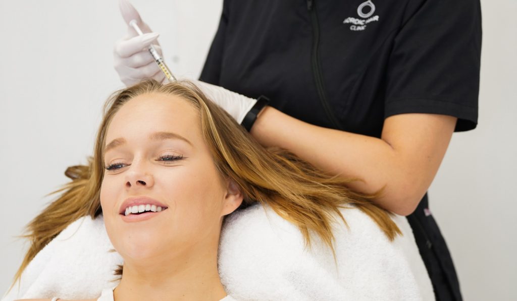 prp-behandling nordic hair clinic
