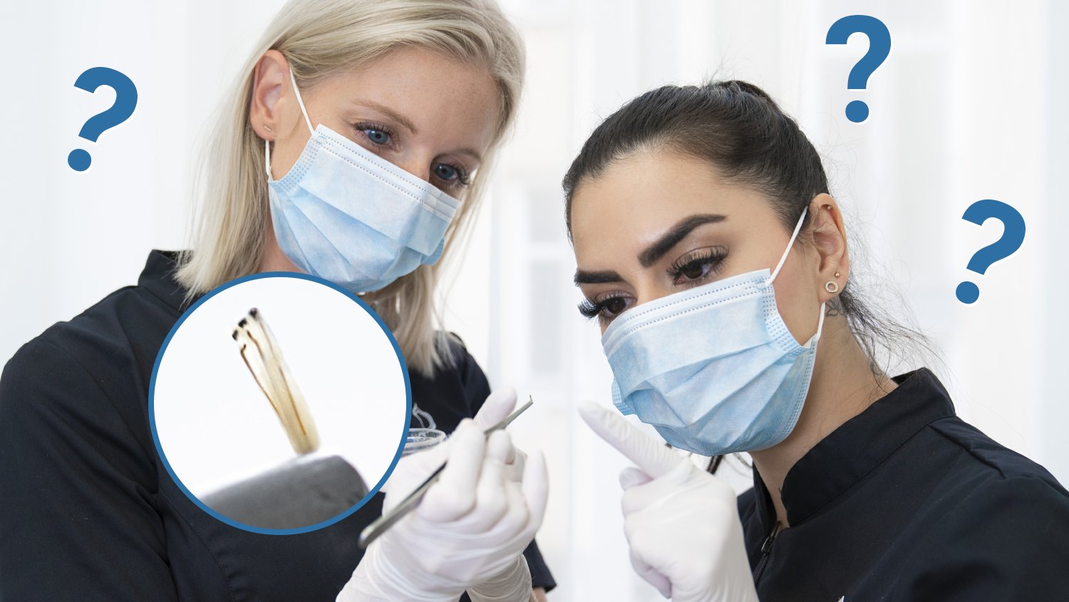 Can you transplant someone else's hair onto yourself? Nordic Hair