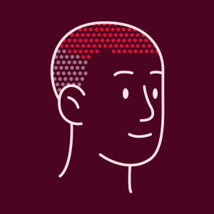 PRP-behandlingskur Standard